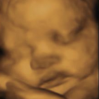 Ultrasonido - Medicina Fetal Campeche