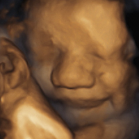 Ultrasonido - Medicina Fetal Campeche