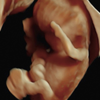 Ultrasonido - Medicina Fetal Campeche