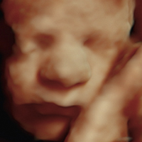 Ultrasonido - Medicina Fetal Campeche